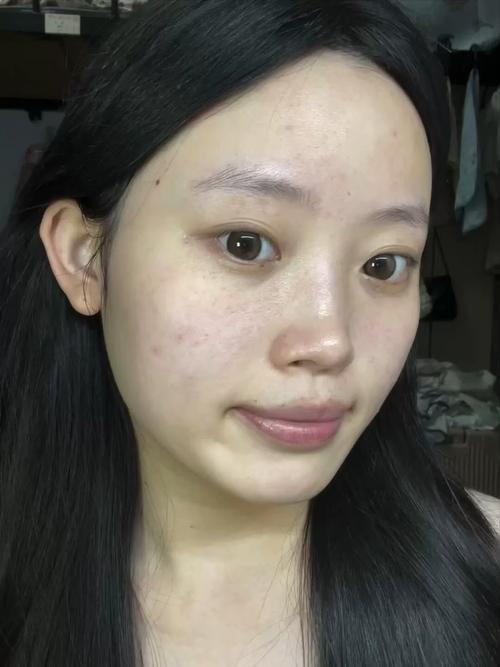 妆点网曝光的祛痘产品，真的靠谱吗？-图3