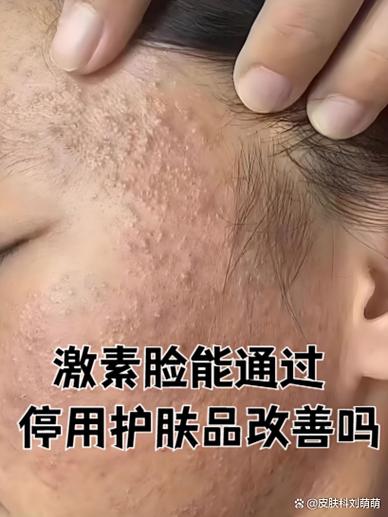 护肤品用后脸粘腻是为什么？-图2