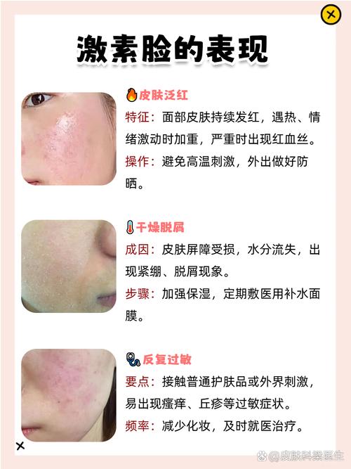 脸过敏可以涂护肤品吗-图1