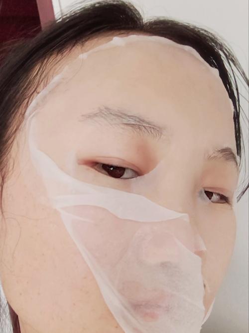 孕妇自制消炎祛痘面膜安全吗?-图2 孕妇自制消炎祛痘面膜安全吗?-图2