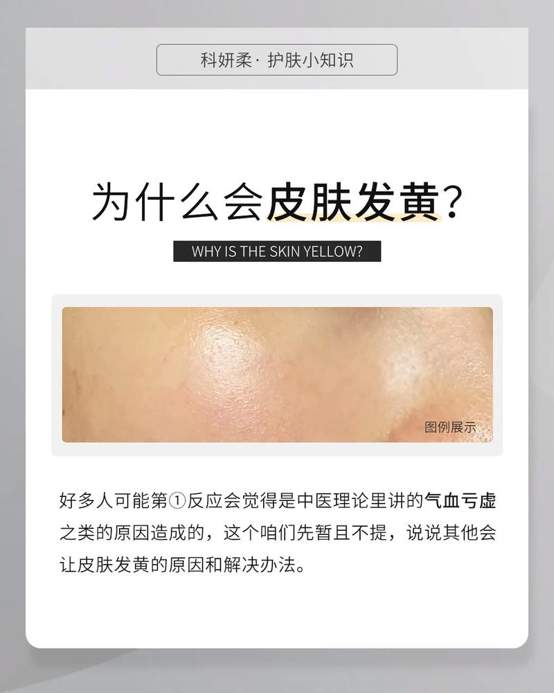 护肤品用后脸发黄是为何?-图1 护肤品用后脸发黄是为何?-图1