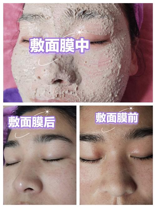 自制中药祛痘保湿面膜效果如何?-图3 自制中药祛痘保湿面膜效果如何?-图3