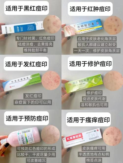 如何快速止痒消红祛痘?-图3 如何快速止痒消红祛痘?-图3