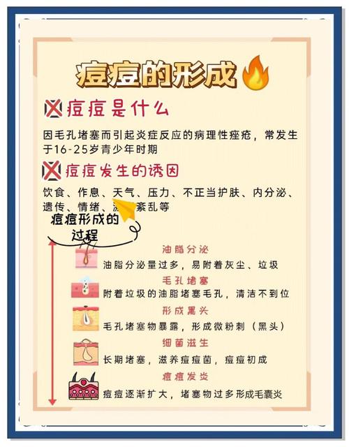 男生如何快速祛痘粉刺?-图3 男生如何快速祛痘粉刺?-图3