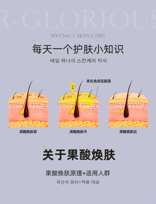 果酸换肤和激光祛痘，哪个祛痘更有效？-图1