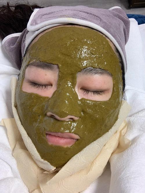 自制白醋面膜祛痘消炎真的有效吗？-图2