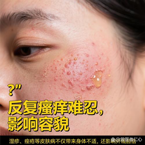 露得清祛痘膏用后脸红是过敏吗？-图2