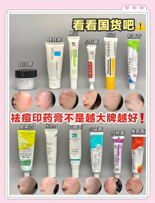 祛痘产品含激素吗？-图3
