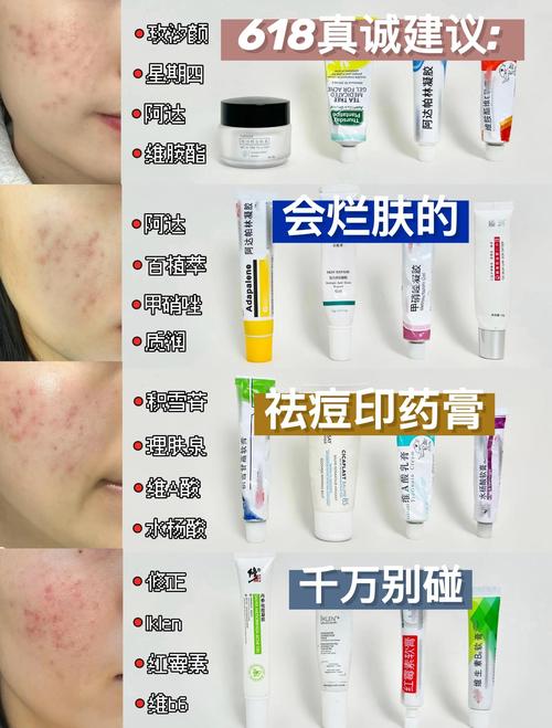 日本男士祛痘产品哪款最有效？-图2