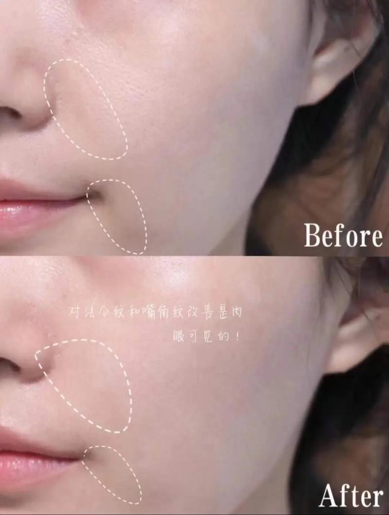 晒伤后护肤品怎么选？-图2