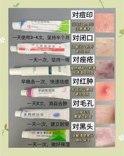 祛痘膏越擦越痘？原因何在？-图2