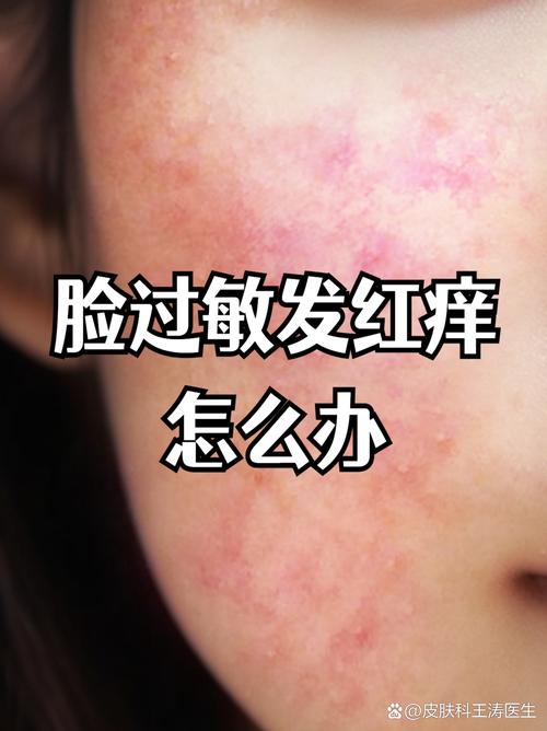 脸过敏必须停用护肤品吗？-图2