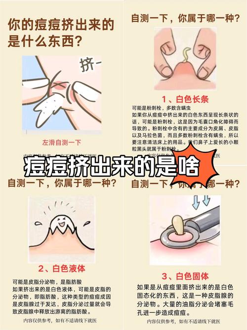 手挤痘安全吗?专业祛痘也需谨慎?-图2 手挤痘安全吗?专业祛痘也需谨慎?-图2