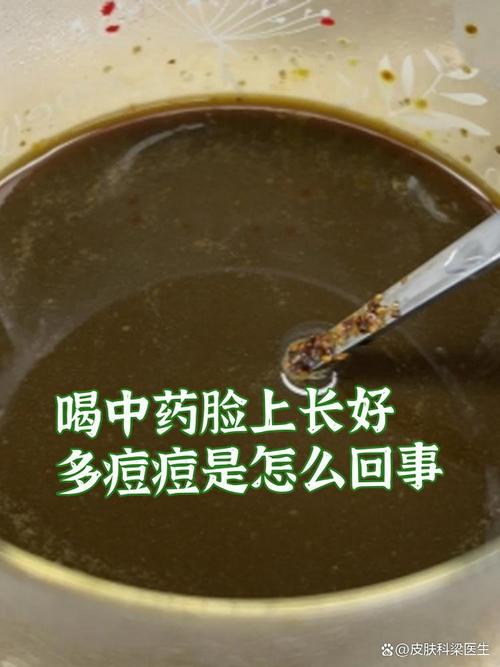 祛痘中药喝完还爆痘，是无效还是排毒？-图1