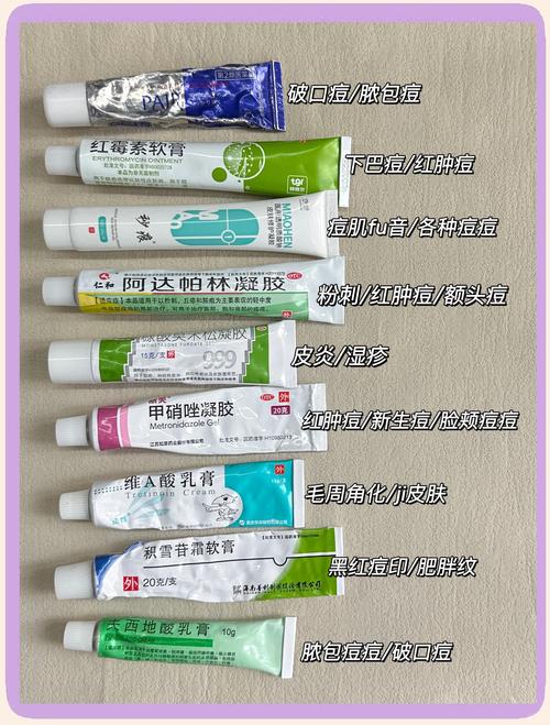 祛痘药膏怎么选？有效祛痘用什么？-图2