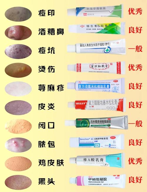 药膏和护肤品,该先用哪个?-图1 药膏和护肤品,该先用哪个?-图1