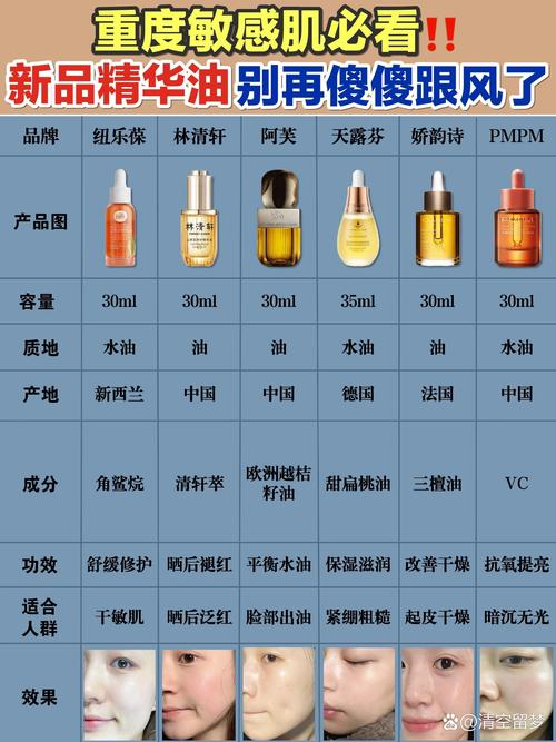 油性肌肤适合用什么护肤品？-图2