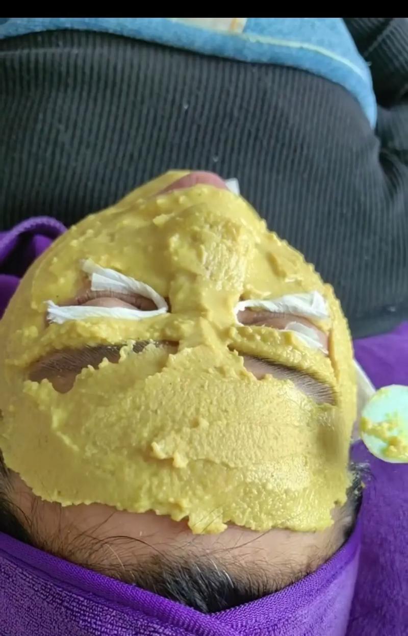 中药面膜祛痘祛斑配方真的有效吗？-图3