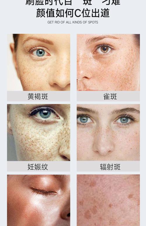 哪些护肤品用后反而会致长斑?-图1 哪些护肤品用后反而会致长斑?-图1