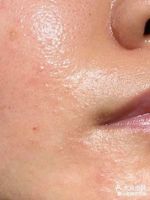 护肤品用后脸很油，是哪里出问题了？-图2