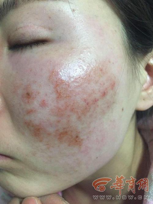 护肤品里加什么会毁容？-图1