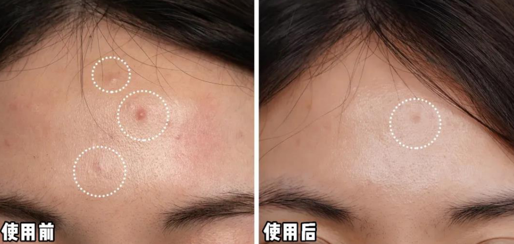 护肤品里加什么会毁容？-图3