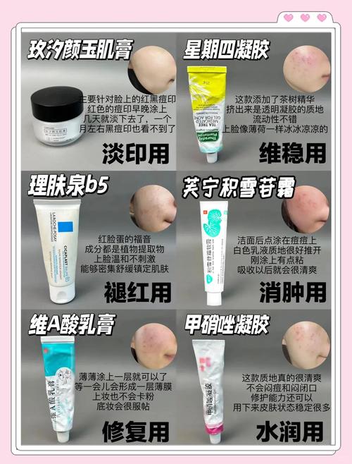 男士祛痘祛痘印，选哪个产品更有效？-图2