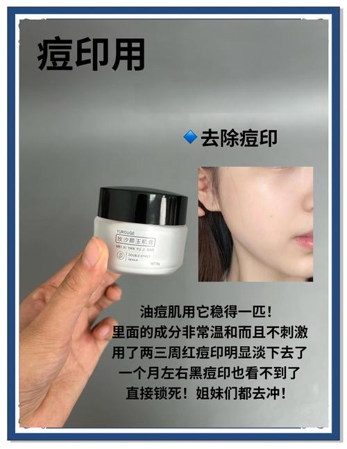 祛痘产品会专门祛痘印吗？-图2