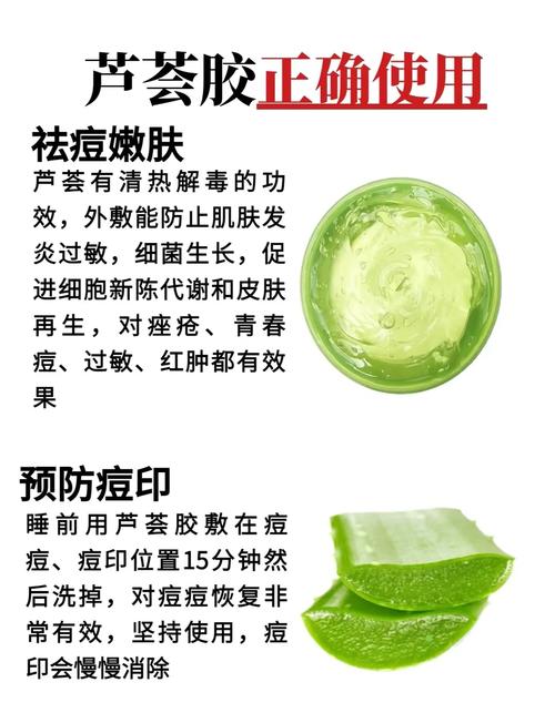 芦荟胶真的能祛痘印吗？-图1