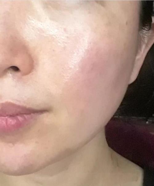 科颜氏祛斑精华去痘印效果如何？-图2