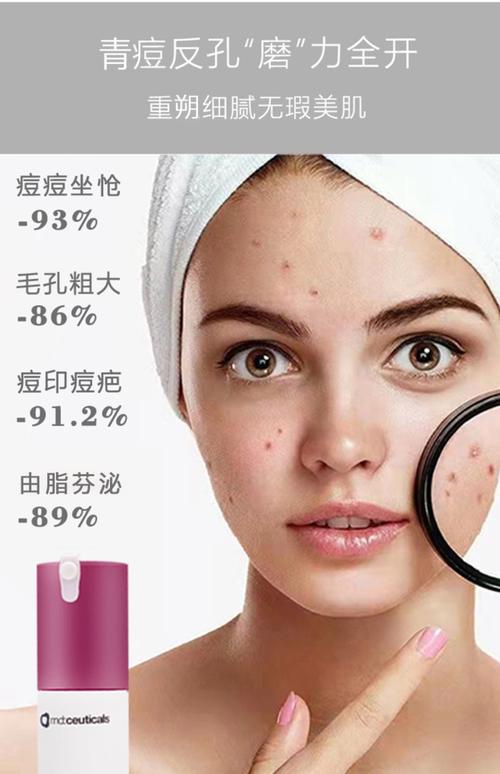 祛痘化妆品真能改善肤质吗？-图2