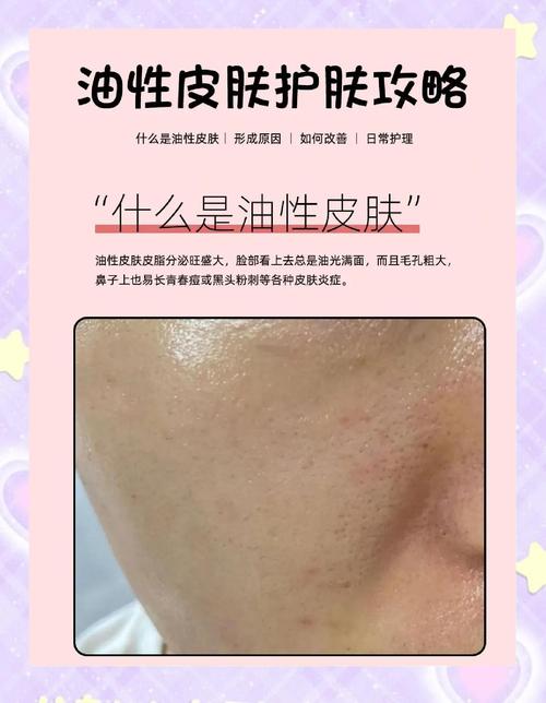 男士油皮护肤步骤怎么选？-图2