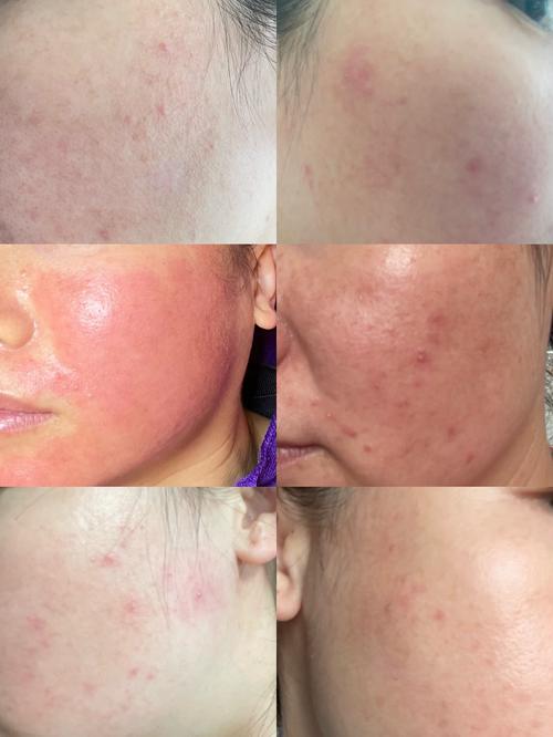 过度护肤，皮肤会伤不起吗？-图1