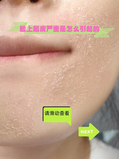 过度护肤，皮肤会伤不起吗？-图3