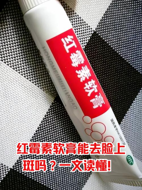 红霉素眼膏真能祛痘印吗？-图2