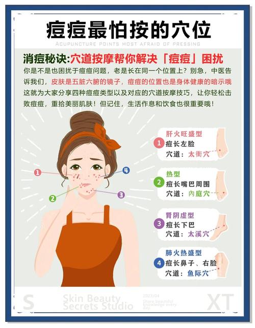 一周真能快速祛痘吗?-图2 一周真能快速祛痘吗?-图2