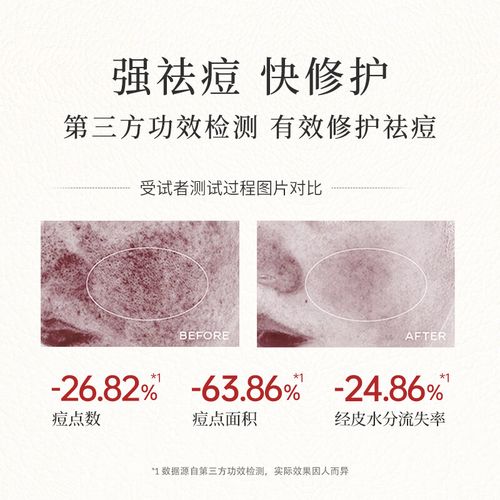 瑷露德玛祛痘有激素吗-图2 瑷露德玛祛痘有激素吗-图2