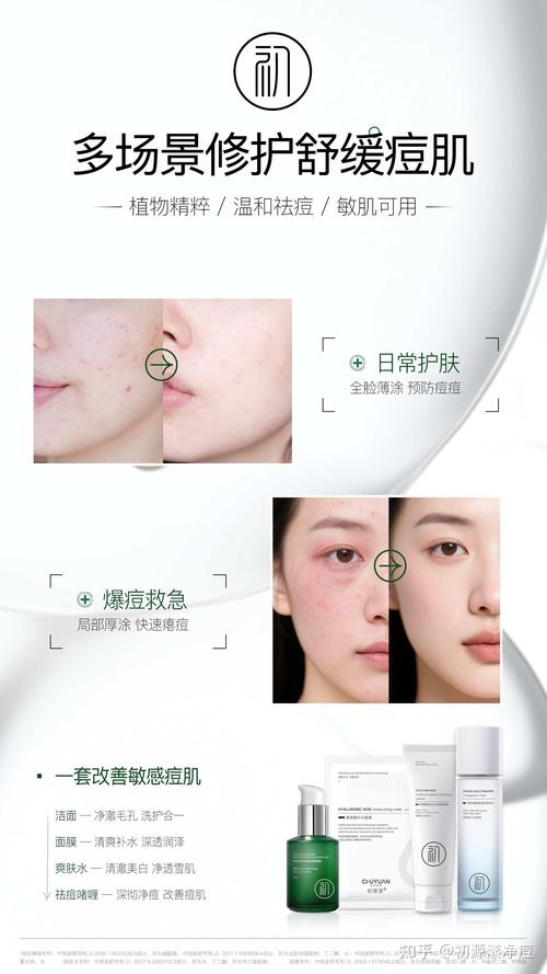 男士祛痘印产品哪个牌子的效果最好？-图1