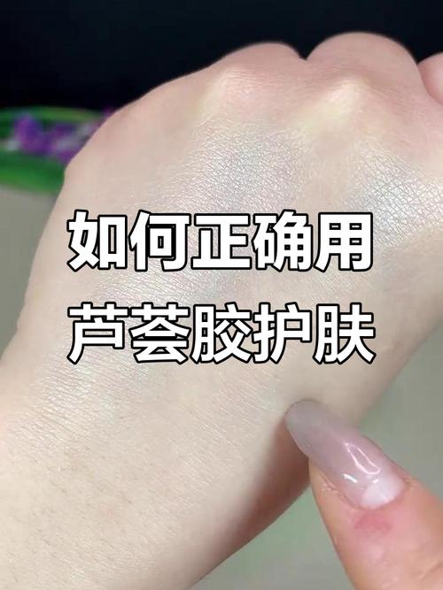 芦荟胶祛痘怎么用才有效？-图2