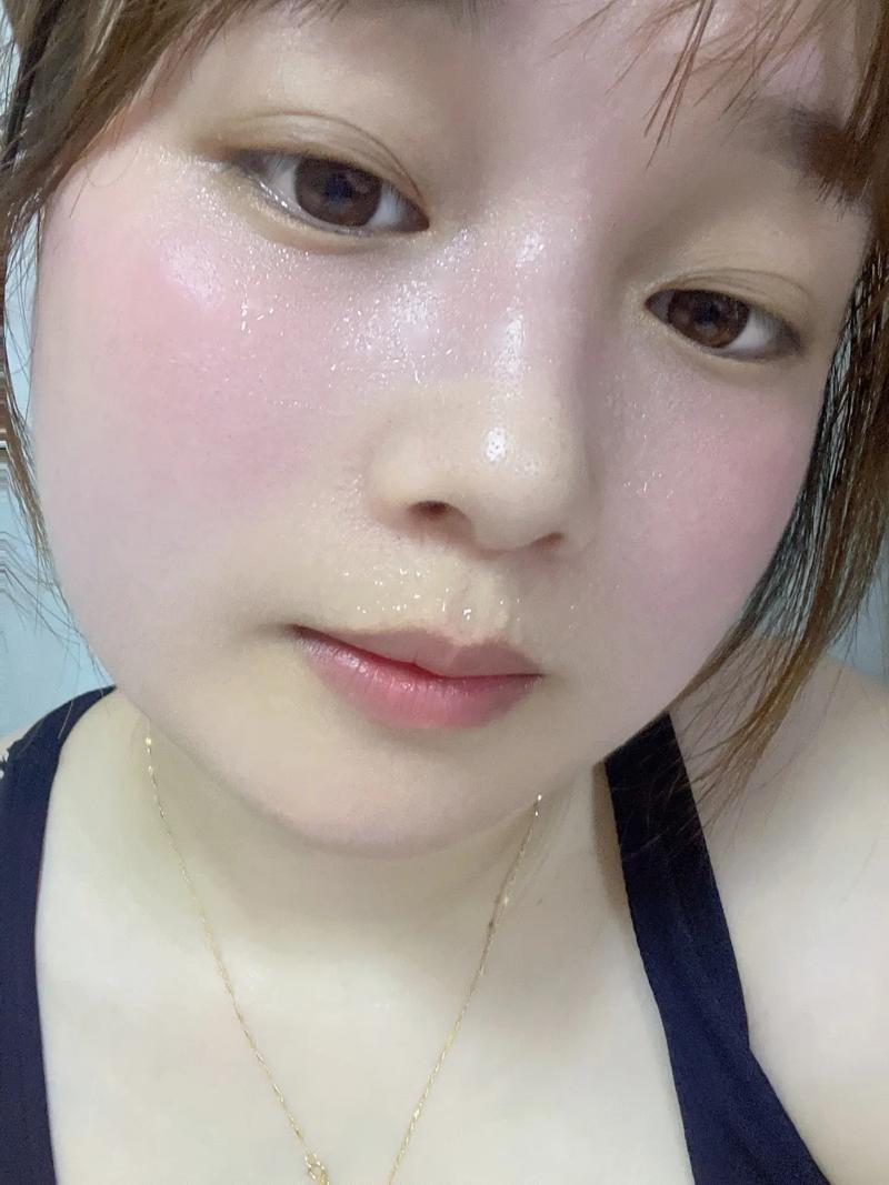 运动出汗真能排毒祛痘？-图2