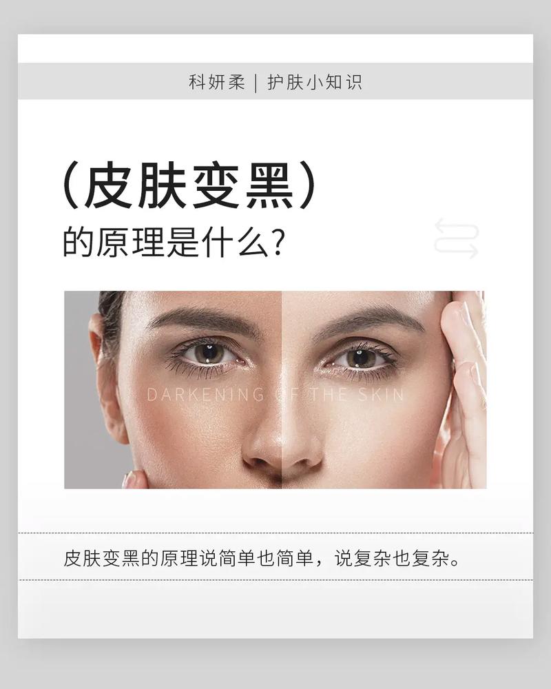 护肤品为何越用越黑？-图1