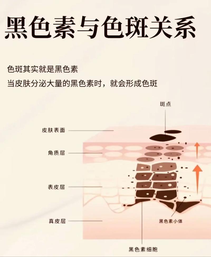 护肤品为何越用越黑？-图2