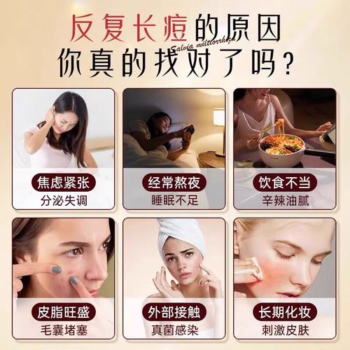 祛痘印用什么中药材好?-图1 祛痘印用什么中药材好?-图1