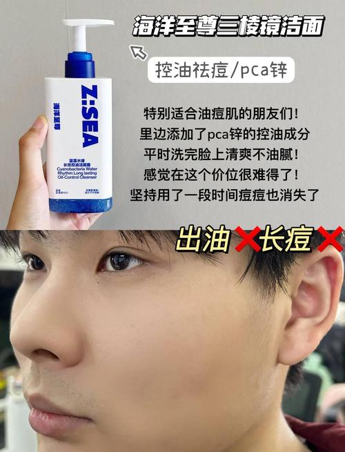 男士祛痘洗面奶怎么选？-图1