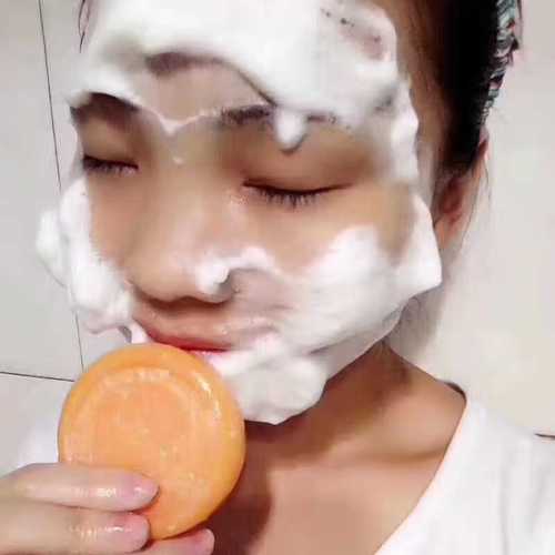 芦荟皂祛痘效果怎么样-图2