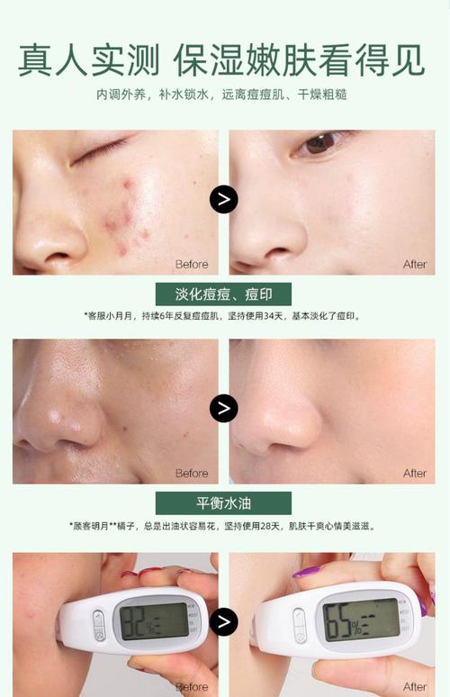 玛茜护肤品有副作用吗？-图1