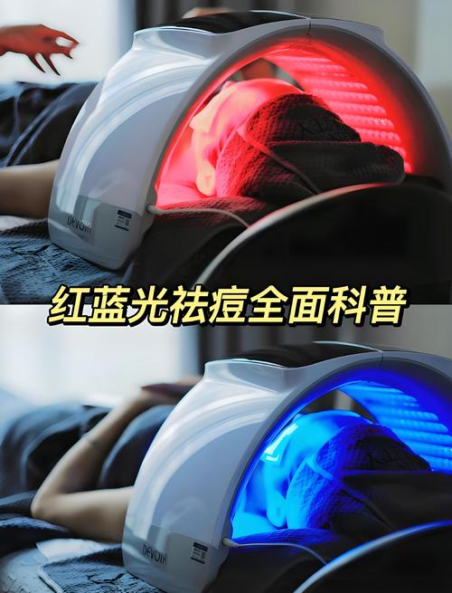 蓝光祛痘的原理是什么？-图3