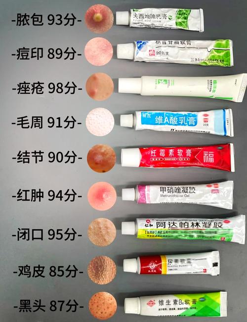 哪款祛痘印的产品最好-图3