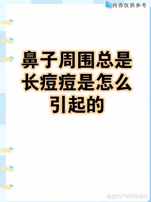 鼻梁长痘怎么快速祛除？-图2