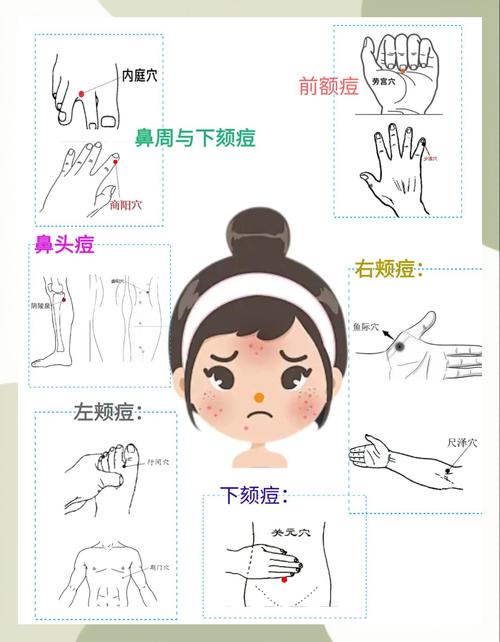 祛痘小妙法真的有效吗？-图1